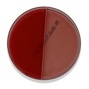 BD 221291 Bbl™ Prepared Media: Trypticase™ Soy Agar with 5% Sheep Blood (TSA II™), MacConkey II Agar, 100/pk