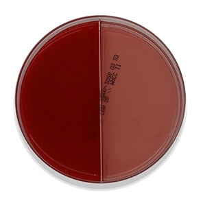 BD 221601 Bbl™ Prepared Media: Plated Media, Prepared, Columbia CNA with 5% Sheep Blood and MacConkey II Agar Bi-Plate Format, 100/pk