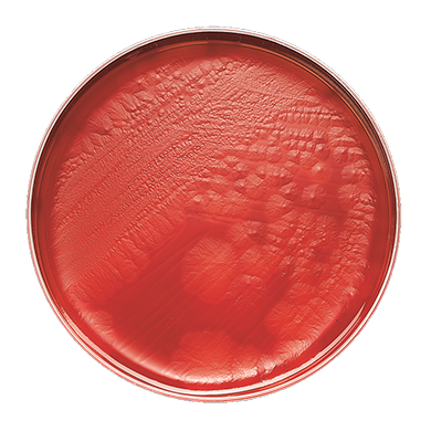 BD 221734 Bbl™ Prepared Media: CDC Anaerobe 5% Sheep Blood Agar, 100/pk (Ships on ice)