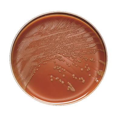 BD 221267 Bbl™ Prepared Media: Chocolate II Agar (GC II Agar with Hemoglobin and IsoVitalex™), 100/pk (Ships on ice)