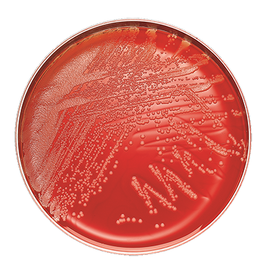 BD 221263 Bbl™ Prepared Media: Plate, Columbia Agar, 5% Sheeps Blood, 100/pk