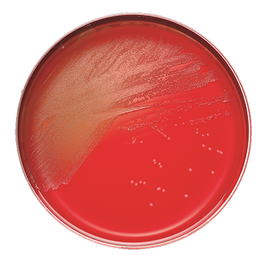 BD 221353 Bbl™ Prepared Media: BBL™ Columbia CNA Agar Plate, with 5% Sheep Blood, 100/pk