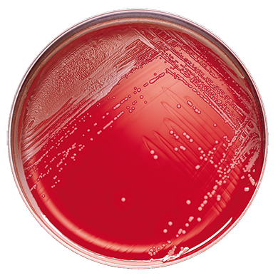 BD 221277 Bbl™ Prepared Media: BBL™ Phenylethyl Alcohol Agar with 5% Sheep Blood, 100/pk