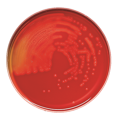 BD 221261 Bbl™ Prepared Media: Trypticase™ Soy Agar with 5% Sheep Blood (TSA II™), 100/pk (Ships on ice)