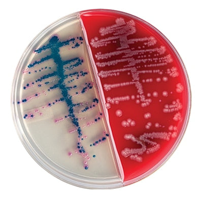 BD 222239 Bbl™ Prepared Media: CHROMagar™ Orientation and BD Trypticase™ Soy Agar II I-Plate, 100/pk